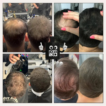 Namka™ – le Camouflage Capillaire qui vous rajeunit. Namilka